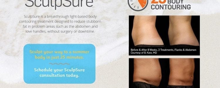 Sculptsure newsletter ad